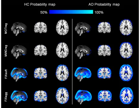 Figure 6 shows the probability maps of BOLD fluctuation reduction across subjects in the two  groups:  the  reduction  is  localized  at  brain  boundaries  after  MOTreg,  a  small  further  decrease  involves the ventricles and the WM after MWCreg, a lar