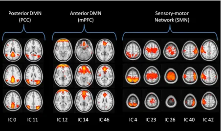Fig. 8. High-dimensional components relative to the neworks of interest automatically selected by the labelling  algorithm with the spatiotemporal-based criteria: the posterior default mode network (PCC) was identified in two  components, the medial prefro