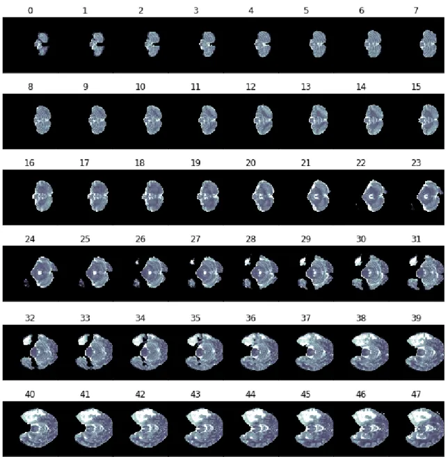 Figure 3.6. An example of the first 48 T 2 slices extracted from a volume, after cropping it to a width of 180, height of 180 and depth of 128 (num