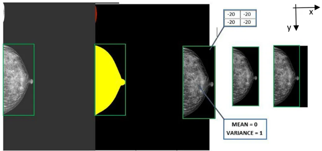 Figure  3.3  Steps  involved  in  data  preparation  applied  to  a  CC  view  mammogram