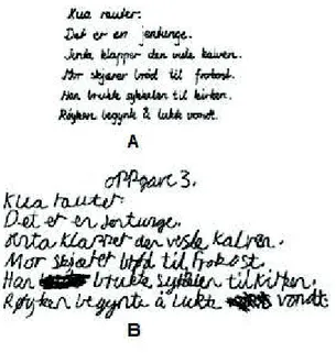 Figura 2.3: Scrittura di un bambino normale (A) messa a confronto con il testo scritto da un bambino con goffaggine e disgrafia (B).