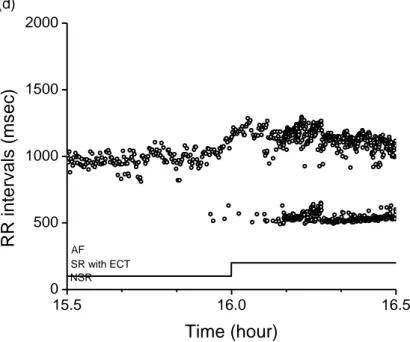 Figure 2. One hour segment of RR interval time series extracted from 24 hour Holter record