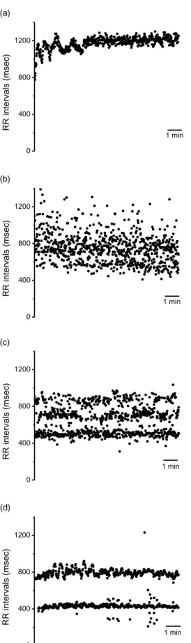 Figure 2.1 10 minutes of RR interval time series from the UVa Holter database for NSR (a), AF (b),  and SR with PVCs (c) and PACs (d)