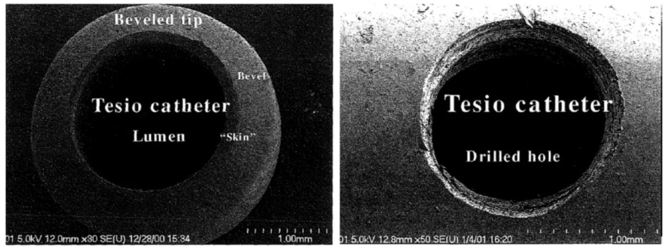 Figure 2.8_Tesio section and Tesio side hole [4]