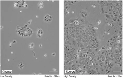 Fig. 1.4 Imaging from electronic microscope of density of BxPC3.  [8]