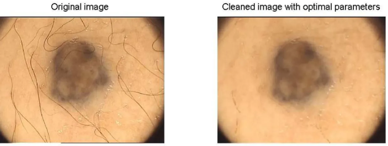 Figure 11: Image with optimal artifacts removal. It is depicted next to the original image