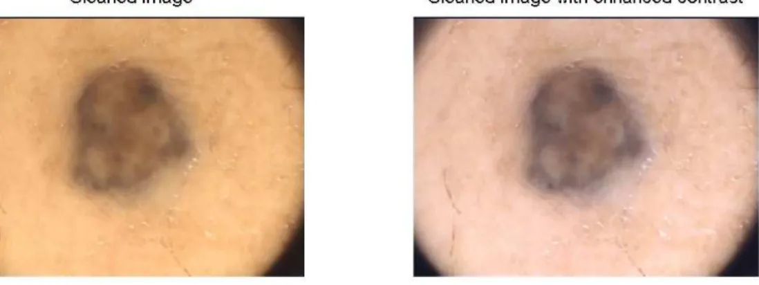 Figure 12: Image with enhanced contrast. Depicted next to the image before the enhancement