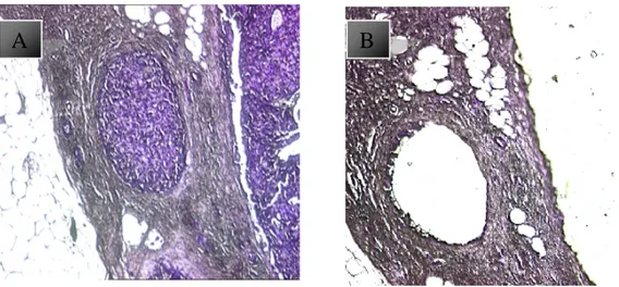 Figure 9: Laser capture microdissection, A) before applying micro- micro-dissection, B) after applying microdissection