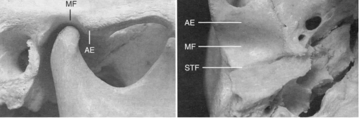 Figura  1  Fossa  glenoidea    visione  laterale  e  inferiore  (da  Okeson  J.  Il  trattamento  delle  disfunzioni  dell’occlusione e dei disordini temporo-mandibolari)