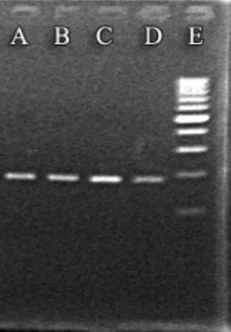 Figura  3.  Amplificato  del  trascritto  di  HAV.  E:  100bp  DNA  Ladder;  A  e  B:  amplificato  dellʼRNA virale HAV; C e D amplificato del trascritto HAV 