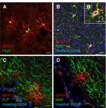 Fig.  4.  Immunohistochemistry  experiments  in  rat  brain  to  detect  GPR17  (red  fluorescence)  in  parallel  with  early  (Olig2  and  NG2)  or  late  (PLP  and  MBP)  markers  of  oligodendrogliogenesis  (green  fluorescence)  as  described  in  Exp