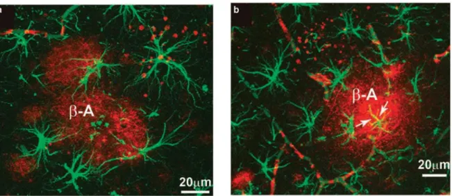 Figura 8 Confocal image showing GFAP-positive (green) reactive astrocytes surrounding b-amyloid plaques  (red; a)