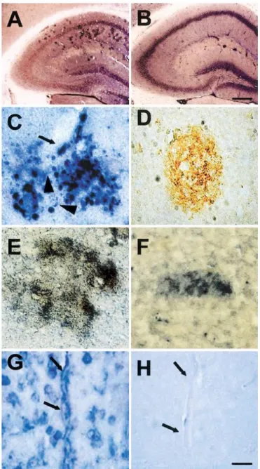 Figure  9  Distribution   of  β-amyloid  plaques  in  AD11  mice.  Immunohistochemistry  with  antibodies  against  Aβ17–24 on brain sections of aged AD11 mice (A) and nontransgenic control (B) reveals the presence of  β-amyloid  plaques  in  the  hippocam