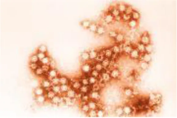 Figura 14: Coxsackie virus B, visione al microscopio elettronico; 