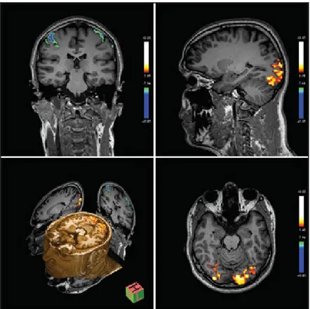 Fig. 13: Immagini di f-MRI ottenute con scanner a 7T.  