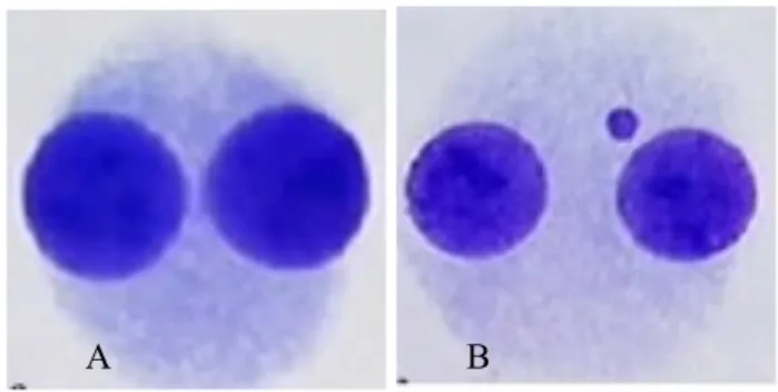 Figura 3: Cellula binucleata a seguito di inibizione della divisione cellulare con trattamento con citocalasina-b: 