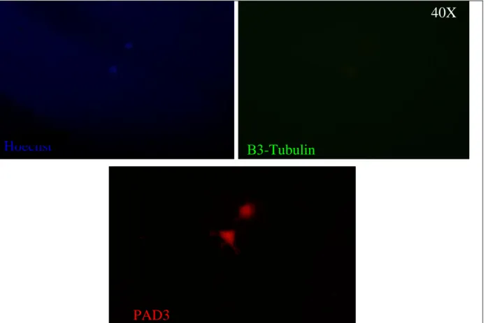 Figure  16-17:  Detection  of  PAD3  (red)  and  β3-Tubulin  (green)  by  immunostainings  in chick  MB  cells  at  passage  27  grown in differentiating medium