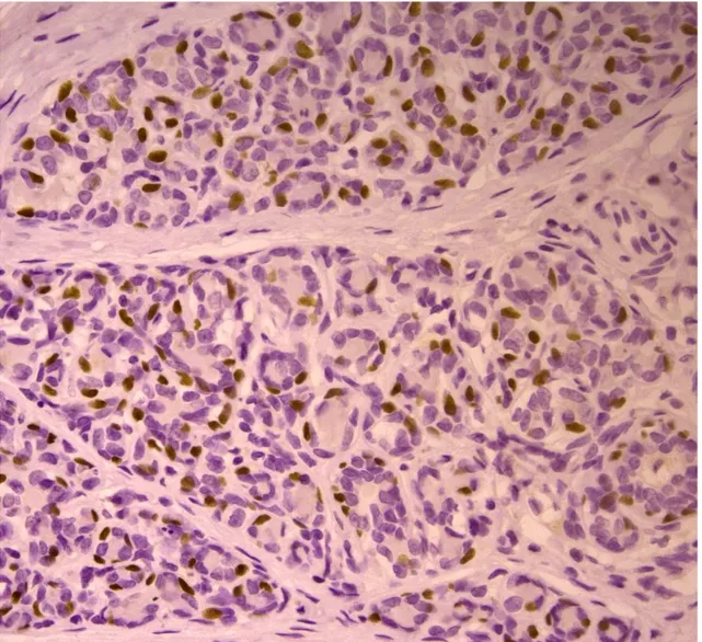 Figura  2:  Espressione  della  proteina  p63  in  iperplasia  mammaria  del  cane. 