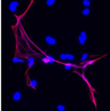 Figura  16.  Una  trappola  extracellulare  dei  neutrofili  (NET,  in  rosso)  cattura  dei  microbi  di  passaggio 