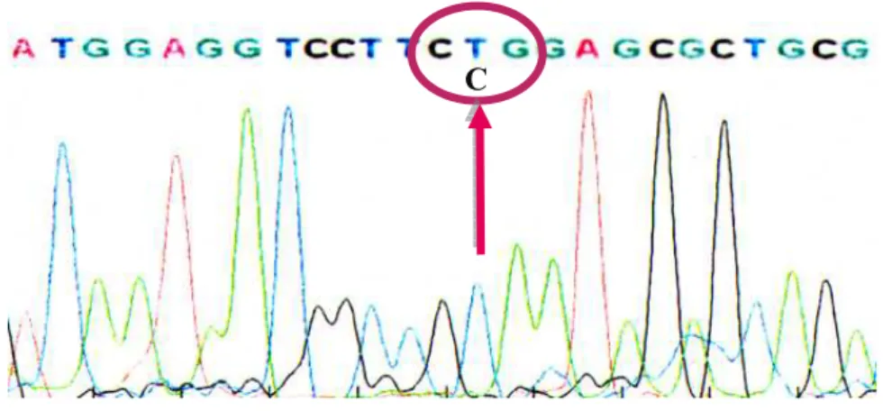 Figura 7: elettroferogramma che mostra la mutazione P112L ritrovata   a livello del codone 112  dell’esone 3 del gene AGPAT2 