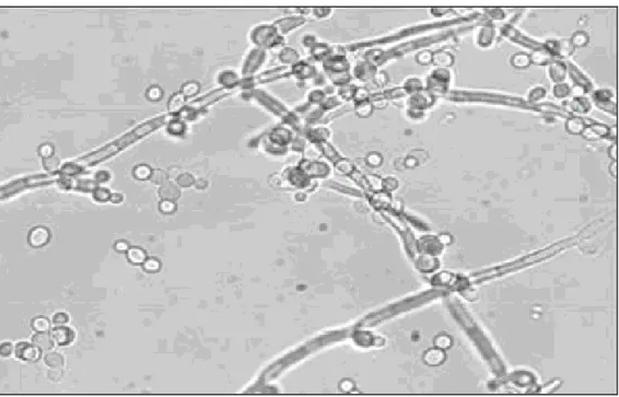 Figura  3  A.  Cellule  lievitiformi,  pseudoife  ed  ife  di  C.  albicans  Ingrandimento 200 X