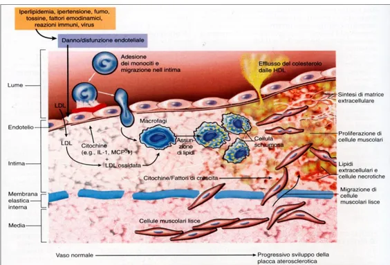 Figura  1.1:  Rappresentazione  schematica  delle  prime  fasi  del  danno  aterosclerotico alla parete