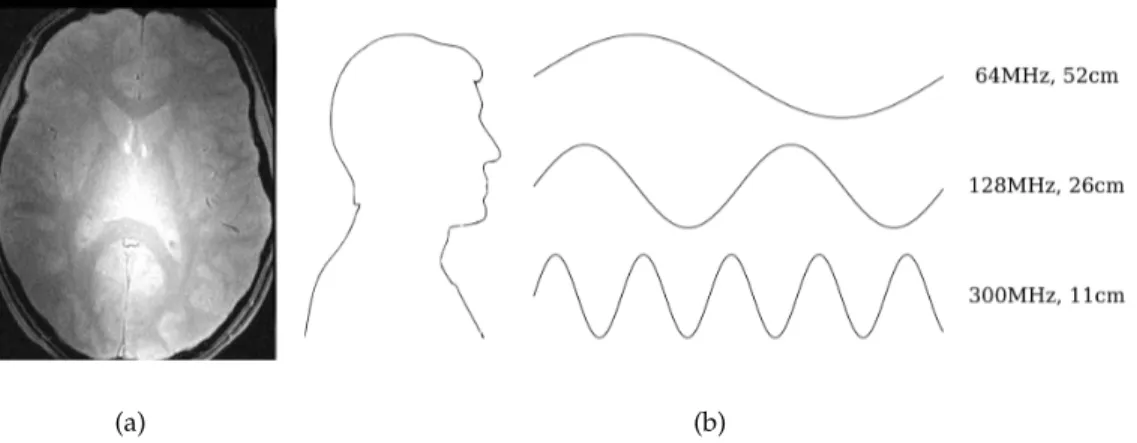 Figura 3.3. Esempio di disomogeneità di campo in un’immagine della testa a 7T (a) e confronto tra la lunghezza d’onda alle varie frequenze e la dimensione della testa umana (b)