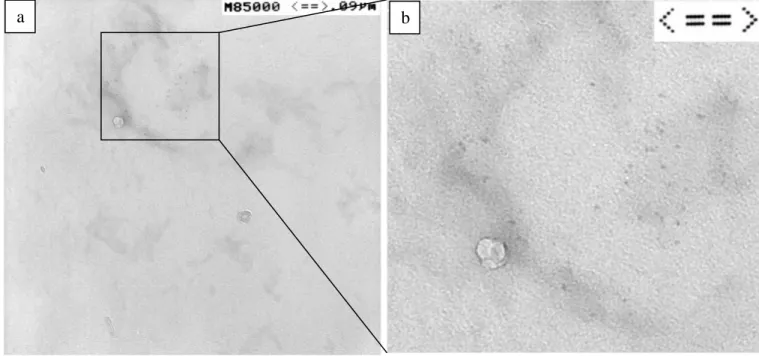 Figure 6.10 TEM images of a) P3HT-b-PAN/CdSe hybrid; b) enlarged view of the surface within  the squared box