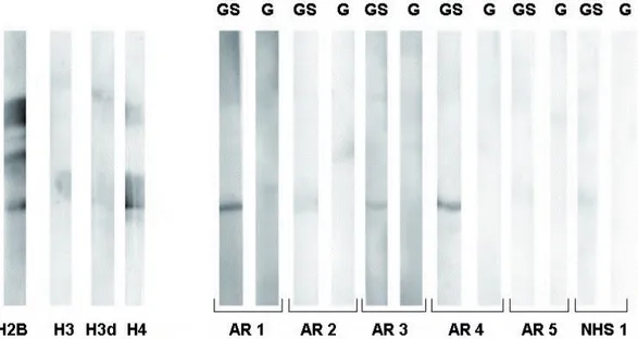 Fig 15. Immunoblot su gel SDS-PAGE 20% AR1-4: sieri di pazienti affetti da AR aCPA positive