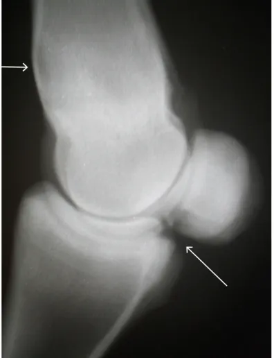 Fig.  14.  Proiezione  LM  del  nodello  posteriore  dx  di  uno  yearling  PSI  (puledro  3’’’)