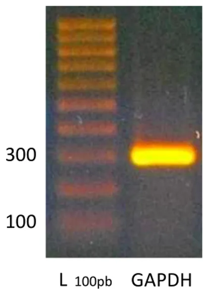Figura  18.  Elettroforesi  su  gel  di  agarosio  per  il  prodotto  di  PCR  con  primer  relativi  alla  GAPDH