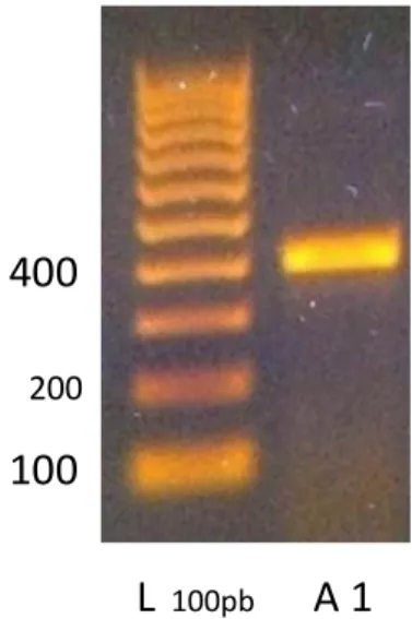 Figura 23. Elettroforesi su gel di agarosio per il prodotto di PCR ottenuto con primer relativi  al recettore A1