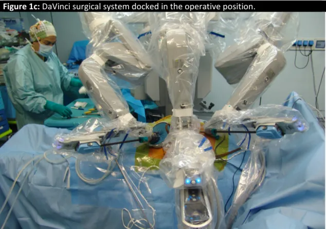 Figure 1c: DaVinci surgical system docked in the operative position. 