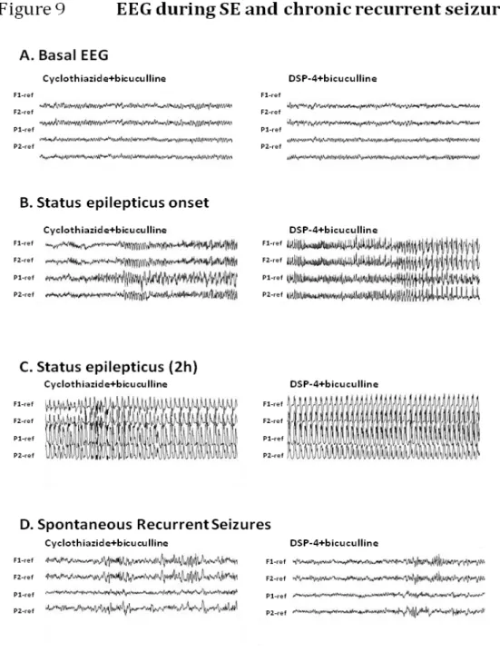 Figure 9. The figure shows representative  EEGs obtained in  animals from the  two  groups  of  SE:  cyclothiazide+bicuculline  (left  column),  and  DSP-4+bicuculline  (right  column)