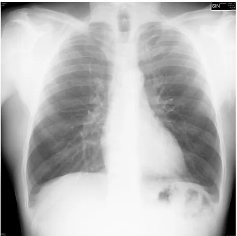 Figura 4: Radiografia del torace di un paziente del gruppo di controllo.   