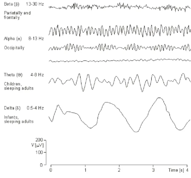 Fig. 11 Ritmi eletroencefalografici 