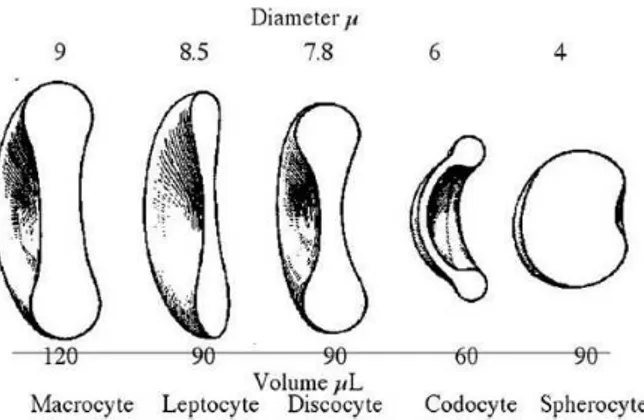 Figura 6 Comparazione fra diametro e volume eritrocitari. Macrociti e leptociti presentano un maggior diametro, ma  sono il macrocita è aumentato di volume