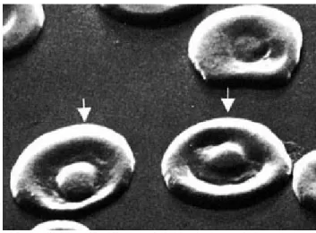 Figura 11 Codociti al microscopio elettronico. Da Bessis M: Blood Smears Reinterpreted, Springer-Verlag, Berlin,  1977, p