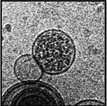 Fig. 4: Cryo-TEM image of liposomes with their  encapsulated content, from Souza 2011[2]