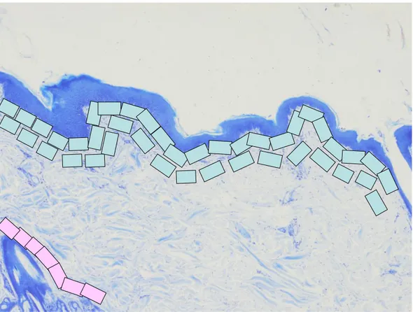 Figure  1:  Mast  cells  morphometry;  a  rappresentation  of  investigation  (pink  rectangle=  perifollicular  areas;  bright  blue  rectangle=  subepidermal  areas
