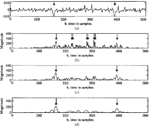 Figura 1.13: Utilizzo della wavelet transform per individuare caratteristiche nel segnale ECG [10]