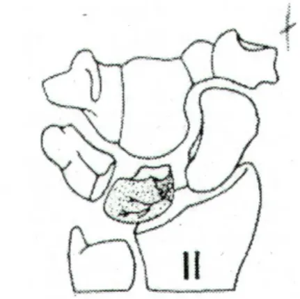 Fig. 5: stadio II secondo Lichtman 