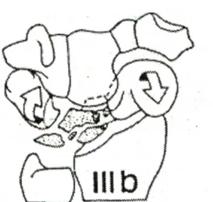 Fig. 7: stadio IIIb secondo Lichtman 