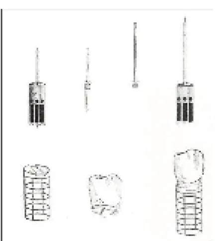 Fig. 9 Impianto di Grienfield in iridio platino 