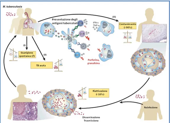Figura 3. Immunopatogenesi della tubercolosi   (modificata da Kaufmann e McMichael, 2005) 