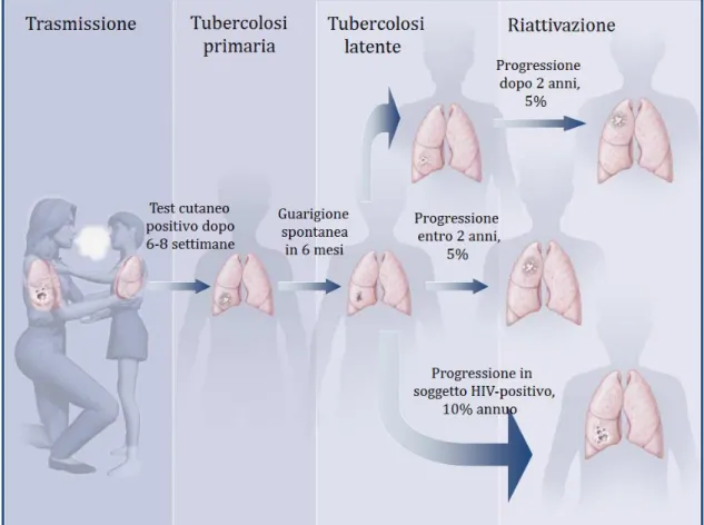 Figura 4. Trasmissione della TB e progressione dalla forma latente alla malattia   (modificata da Small e Fujiwara, 2001) 