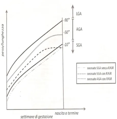Figura 2: Il neonato SGA e la restrizione di crescita intrauterina (IUGR). 