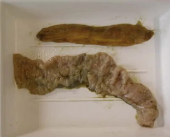 Figura 5: Paratubercolosi caprina. Confronto tra porzione di intestino normale (in alto)   e in preda ad enterite proliferativa, con il tipico aspetto “a scala di corda”(in basso)