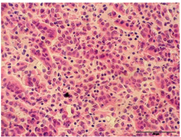 Figura 6: Paratubercolosi caprina. Quadro istologico della lesione intestinale, caratterizzato   dalla presenza diffusa di una popolazione di macrofagi epitelioidi a livello della lamina propria 