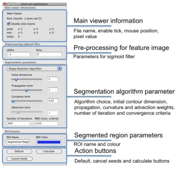 Figure 1.6: Level Set plugin filter panel - Level set plugin panel divided into ﬁve parts: Main viewer information, pre-processing for the feature image,  seg-mentation algorithm parameters, segmented region parameters and action button